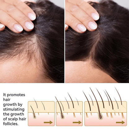 FEG Hair Growth Spray 100% Original For Both Men & Women